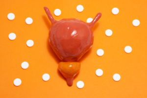 Model or figure of urinary bladder and prostate, which corresponds to anatomical original is located in orange background surrounded by white pills ornamented in polka dots, highlighting Overactive Bladder.