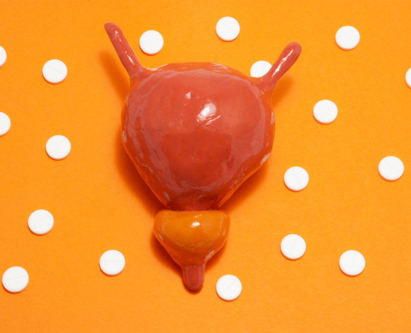 Model or figure of urinary bladder and prostate, which corresponds to anatomical original is located in orange background surrounded by white pills ornamented in polka dots, highlighting Overactive Bladder.