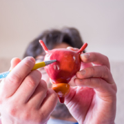 Doctor on defocused background holds in his hand anatomic model of bladder with prostate, pointing with pen in hand on urinary bladder in foreground. Localizing pathology, illness or problems, discussing urodynamic testing.