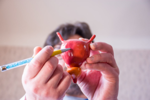 Doctor on defocused background holds in his hand anatomic model of bladder with prostate, pointing with pen in hand on urinary bladder in foreground. Localizing pathology, illness or problems, discussing urodynamic testing.