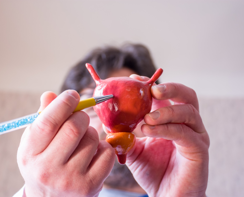 Doctor on defocused background holds in his hand anatomic model of bladder with prostate, pointing with pen in hand on urinary bladder in foreground. Localizing pathology, illness or problems, discussing urodynamic testing.