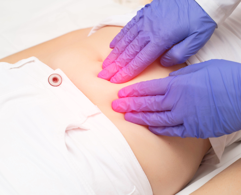 A gynecologist doctor probes the lower abdomen of a girl who has pain and inflammation of the reproductive system. Ovarian cyst, endometriosis, pregnancy pathology, discussing a new uterine fibroid treatment called Acessa.