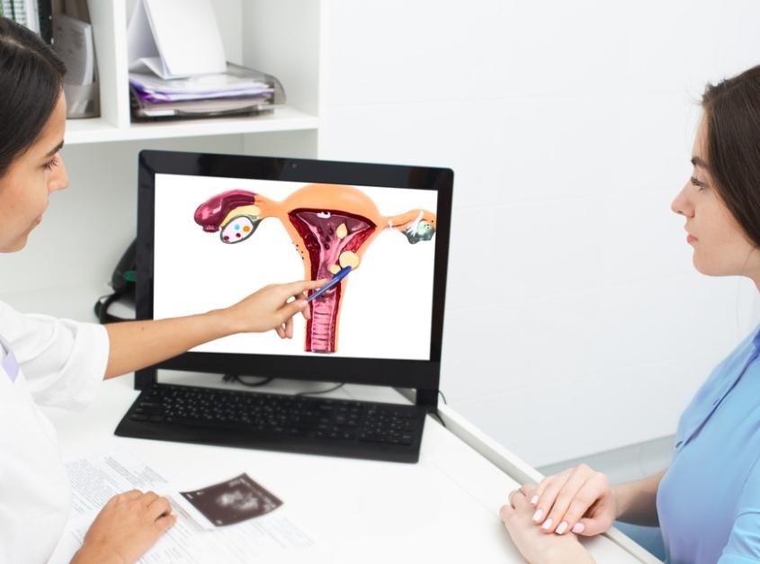 gynecologist explaining a diagram to a woman